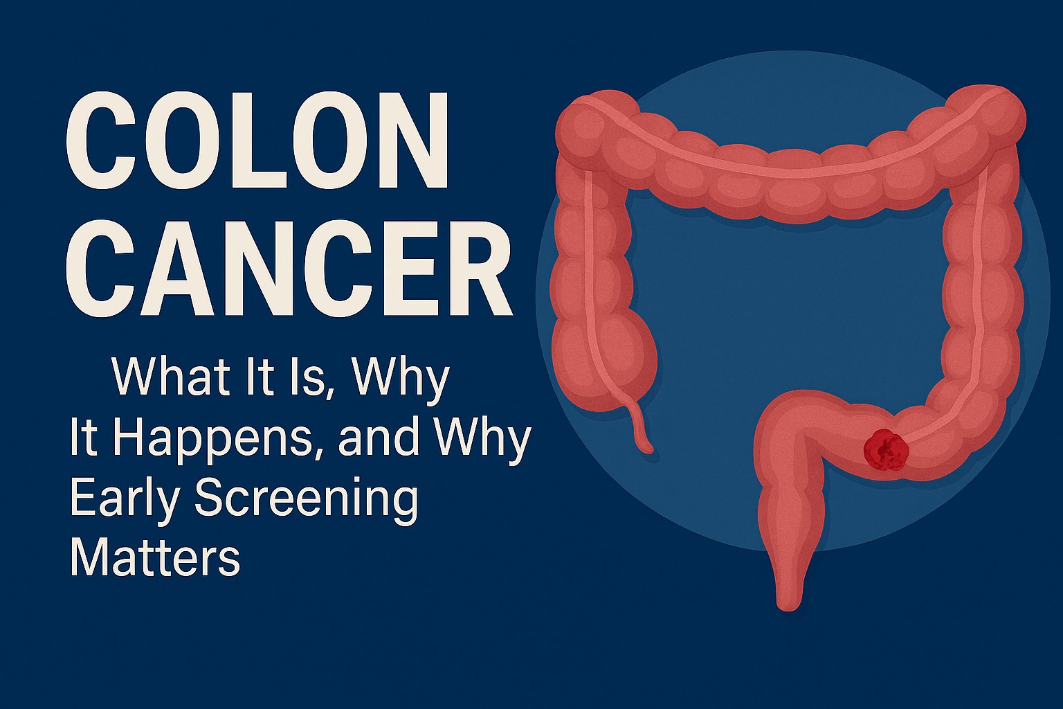 Illustration of the human colon with a visible tumor, alongside bold white text reading “Colon Cancer: What It Is, Why It Happens, and Why Early Screening Matters” on a deep blue background.